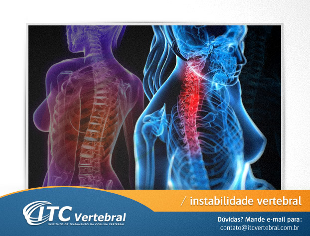 instabilidade vertebral tratamento fisioterapia