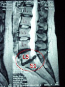 imagens-radiologicas-da-coluna-vertebral-1