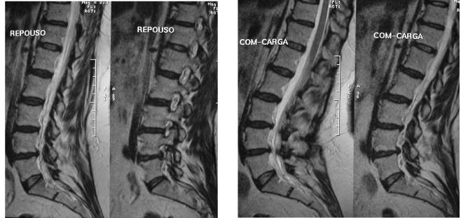 imagens-radiologicas-da-coluna-vertebral-2