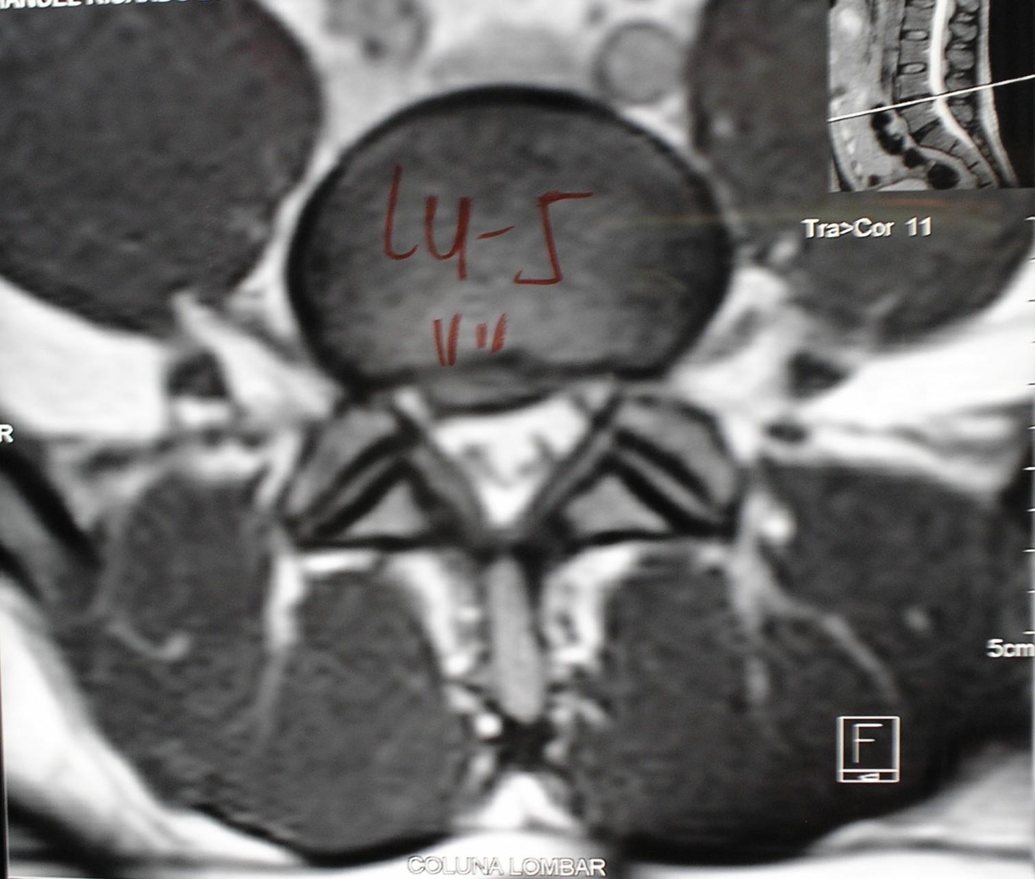 imagens-radiologicas-da-coluna-vertebral-3