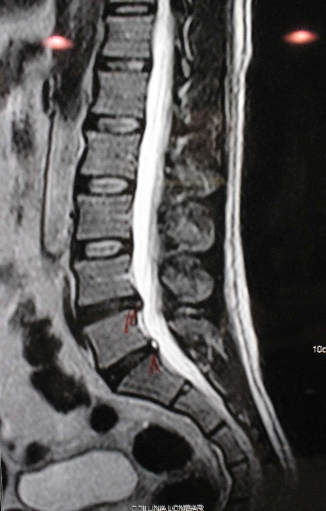 imagens-radiologicas-da-coluna-vertebral-4
