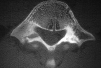 imagens-radiologicas-da-coluna-vertebral-5